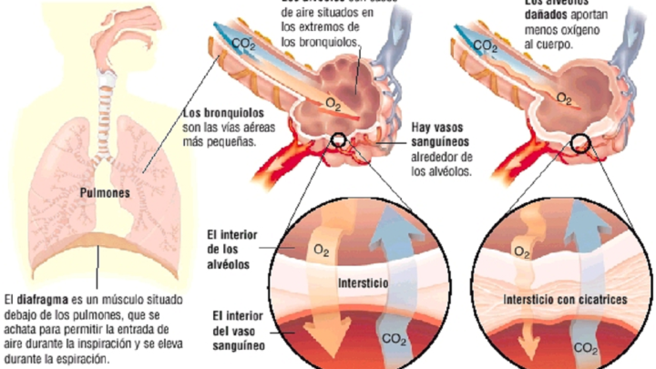 DESARROLLO DE NUEVAS TERAPIAS ANTIFIBRÓTICAS