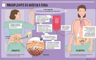 SEIS ENFERMEDADES POCO CONOCIDAS TRATABLES CON TRASPLANTE DE MÉDULA ÓSEA