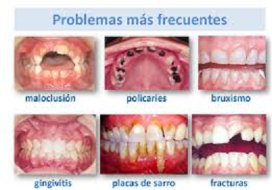 POR CONFINAMIENTO AUMENTAN PROBLEMAS DE SALUD BUCAL