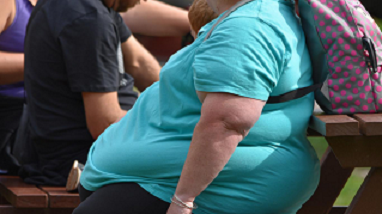 OBESIDAD, KILOS DE RAZONES PARA TOMARLA EN SERIO OBESIDAD, KILOS DE RAZONES PARA TOMARLA EN SERIO