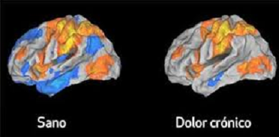 INTELIGENCIA ARTIFICIAL Y TECNOLOGÍA PARA LA MEDICIÓN DEL DOLOR