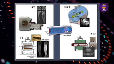 NUEVA TECNOLOGÍA PARA LOGRAR MEJORES IMÁGENES POR RESONANCIA MAGNÉTICA