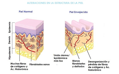 REMODELAR LA MATRIZ DE LA PIEL