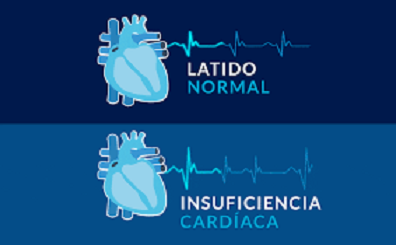 MEJORAR LA ATENCIÓN DE LA INSUFICIENCIA CARDÍACA EN MÉXICO