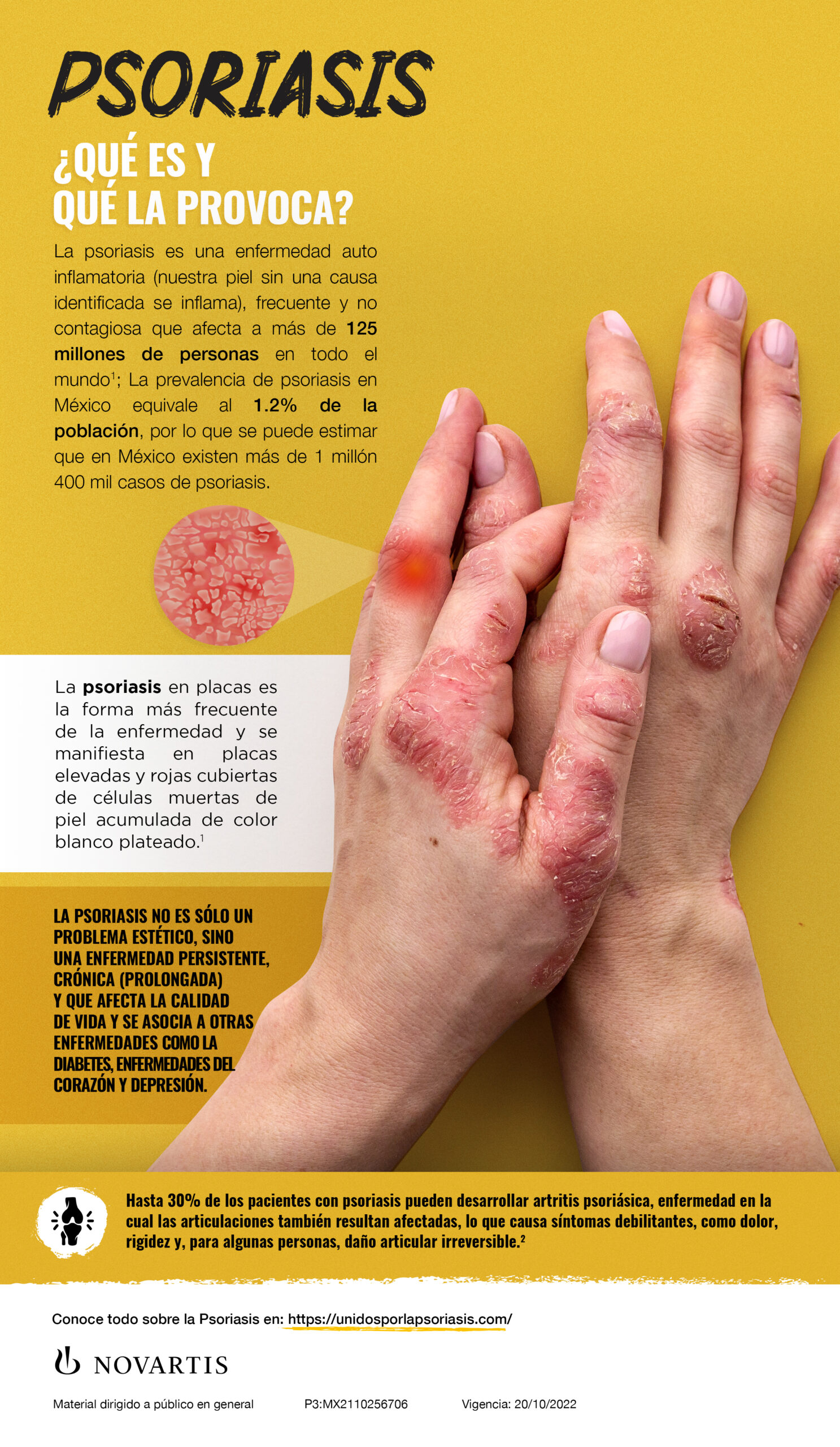 PSORIASIS, IMPACTA LA VIDA