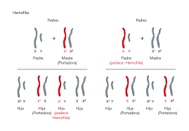 LA DEFICIENCIA HEREDITARIA DEL FACTOR X