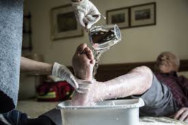 CADA 30 SEGUNDOS SE PIERDE UNA EXTREMIDAD INFERIOR POR AMPUTACIÓN