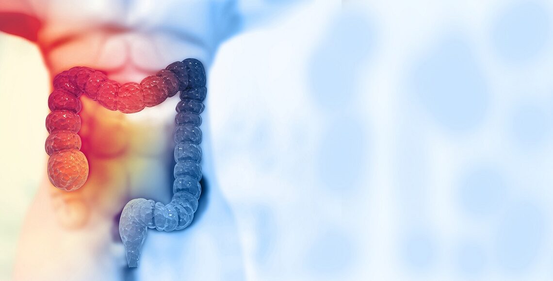 EL CÁNCER DE COLON CADA VEZ MÁS EN ADULTOS JÓVENES EL CÁNCER DE COLON CADA VEZ MÁS EN ADULTOS JÓVENES