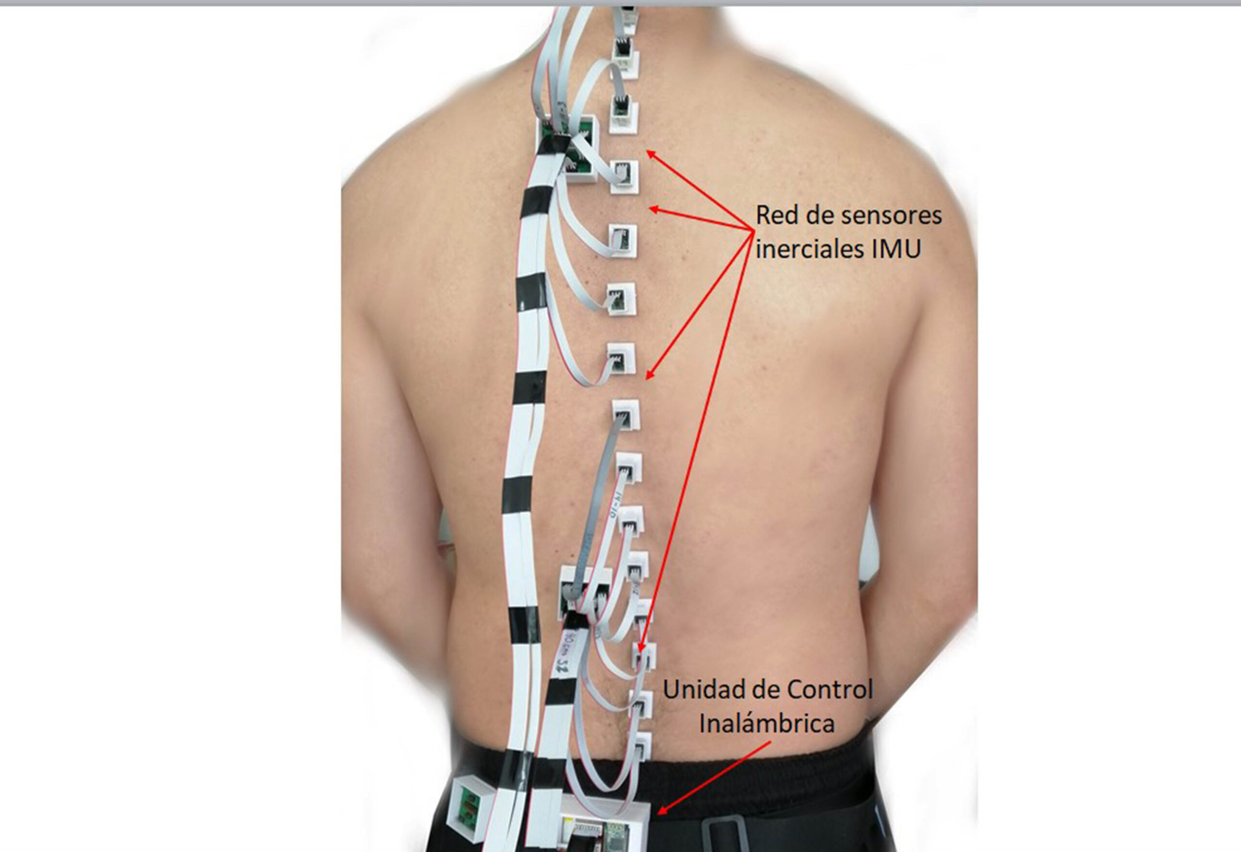 SISTEMA ÚNICO PARA MONITOREAR MOVIMIENTO DE COLUMNA VERTEBRAL