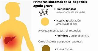 DOLOR ABDOMINAL, DIARREA Y VÓMITO PRECEDEN CASOS DE HEPATITIS AGUDA GRAVE EN NIÑOS