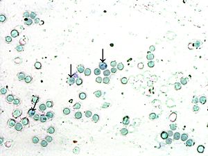 IDENTIFICAN CÉLULAS QUE REGULAN EL SISTEMA INMUNE EN LOS RECIÉN NACIDOS