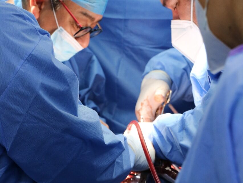 POR PRIMERA VEZ , HOSPITAL GENERAL DE MÉXICO REALIZA TRASPLANTE DE CORAZÓN POR PRIMERA VEZ , HOSPITAL GENERAL DE MÉXICO REALIZA TRASPLANTE DE CORAZÓN