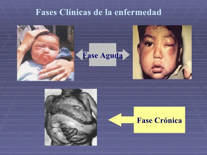 ALIANZA PARA AVANZAR EN LA ELIMINACIÓN DE LA TRANSMISIÓN MATERNOINFANTIL DE LA ENFERMEDAD DE CHAGAS