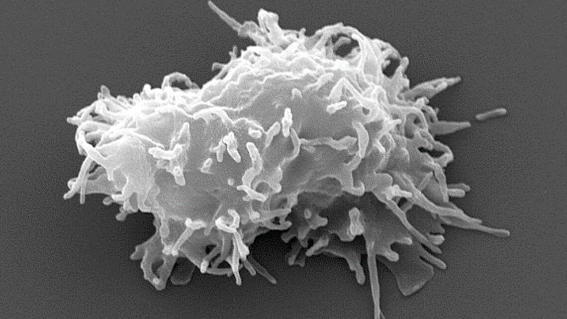 EXPLORAN PAPEL DE NEUROTRANSMISORES DURANTE INFECCIÓN POR AMIBAS EXPLORAN PAPEL DE NEUROTRANSMISORES DURANTE INFECCIÓN POR AMIBAS