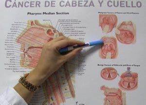TU CUERPO ALERTA LA PRESENCIA DE CÁNCER DE CABEZA Y CUELLO