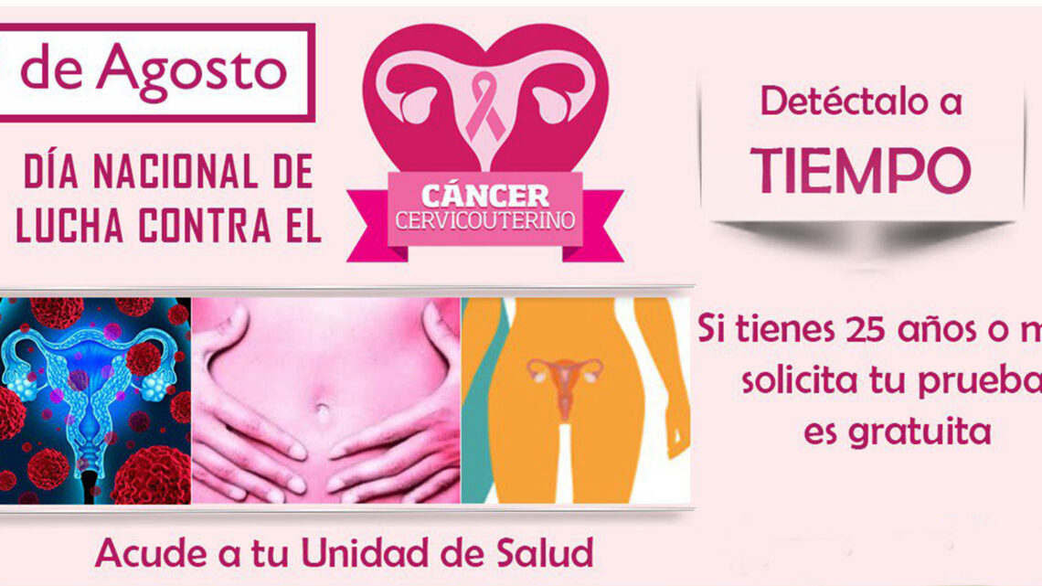 CURABLE 90% CASOS DE CÁNCER CERVICOUTERINO DETECTADO A TIEMPO CURABLE 90% CASOS DE CÁNCER CERVICOUTERINO DETECTADO A TIEMPO