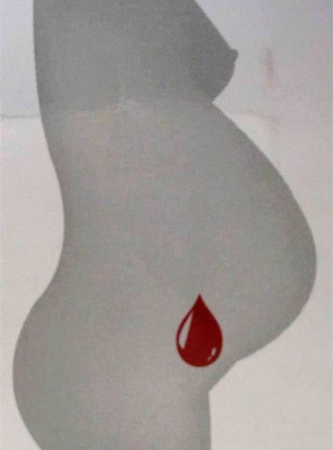 HEMORRAGIA OBSTÉTRICA