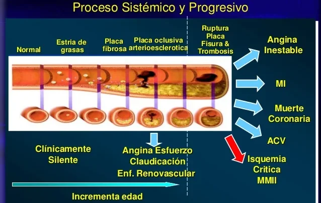 ENFERMEDAD ARTERIAL PERIFÉRICA