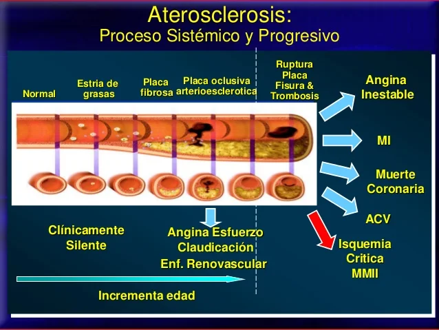 ENFERMEDAD ARTERIAL PERIFÉRICA