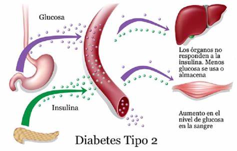 MILLONES DE MEXICANOS VIVEN CON DIABETES TIPO 2; LA MITAD LO DESCONOCE