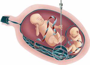 PRIMERA CLÍNICA DE CIRUGÍA PERINATAL DE ALTA ESPECIALIDAD