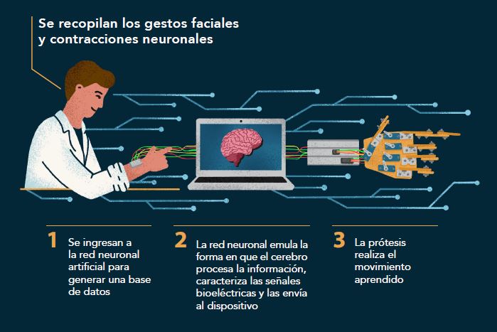 PRÓTESIS QUE FUNCIONA CON IMPULSOS BIOELÉCTRICOS