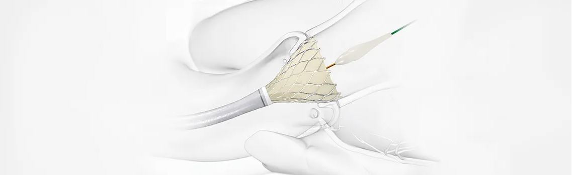 MAYOR DURABILIDAD DE VÁLVULAS AÓRTICAS