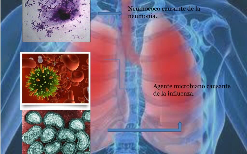 TEMPORADA INVERNAL Y ENFERMEDADES RESPIRATORIAS AGUDAS