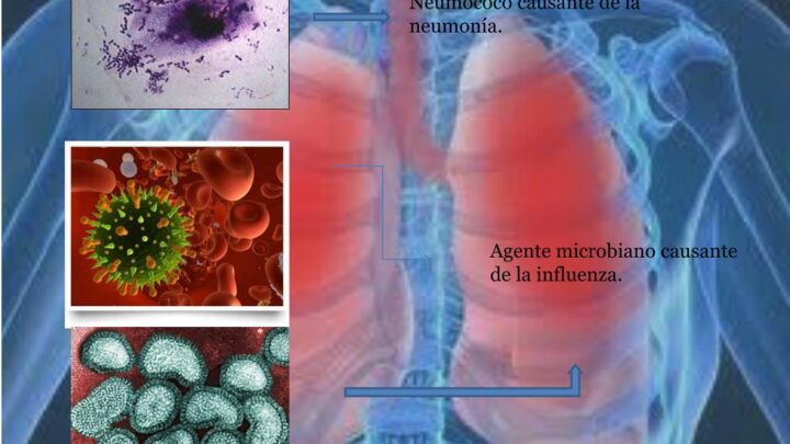 TEMPORADA INVERNAL Y ENFERMEDADES RESPIRATORIAS AGUDAS