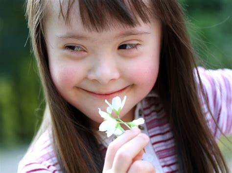 PERSONAS CON SÍNDROME DE DOWN PUEDEN VIVIR HASTA 65 AÑOS