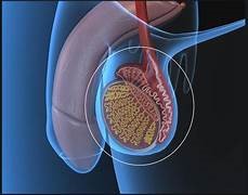 RIESGO DE CÁNCER DE TESTÍCULO AUMENTA ENTRE LOS 18 Y 35 AÑOS