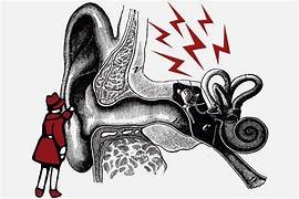 LA OTITIS DE VERANO ES MÁS COMÚN EN EL PERIODO VACACIONAL LA OTITIS DE VERANO ES MÁS COMÚN EN EL PERIODO VACACIONAL