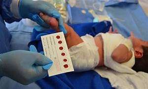 EL TAMIZ NEONATAL EL TAMIZ NEONATAL