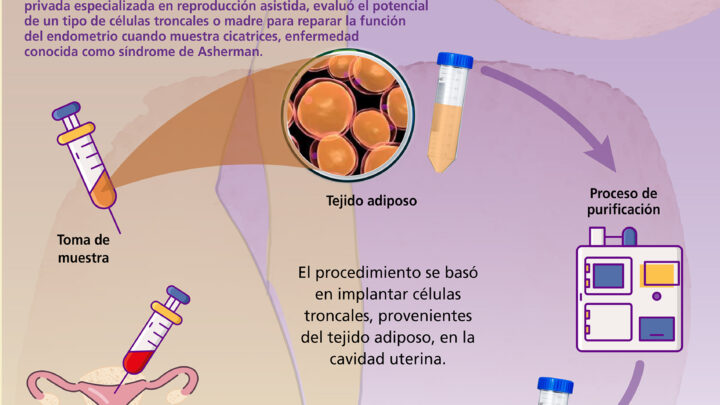 TERAPIA CELULAR PARA PROBLEMAS DE FERTILIDAD FEMENINA