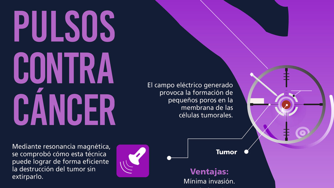 TRATAMIENTO DE MÍNIMA INVASIÓN CONTRA EL CÁNCER DE MAMA