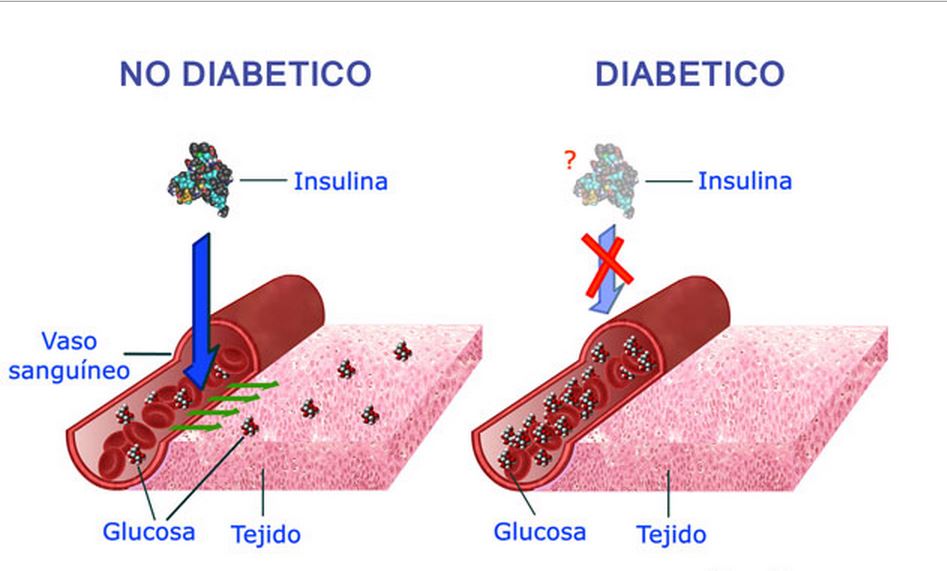 MILLONES DE MEXICANOS TIENEN DIABETES MELLITUS FUERA DE CONTROL MILLONES DE MEXICANOS TIENEN DIABETES MELLITUS FUERA DE CONTROL