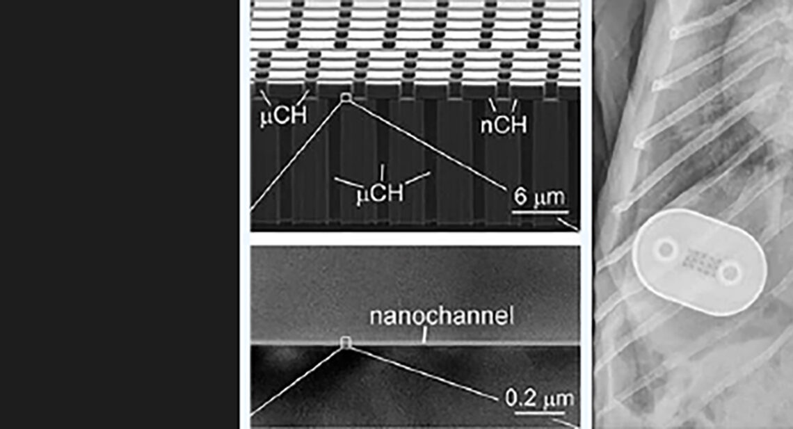LA PREVENCIÓN DEL VIH PRONTO SERÁ «INFALIBLE»