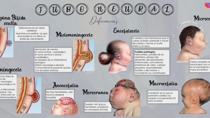 DEFECTOS AL NACIMIENTO, ASOCIADOS CON FACTORES GENÉTICOS, AMBIENTALES Y FALTA DE MICRONUTRIENTES