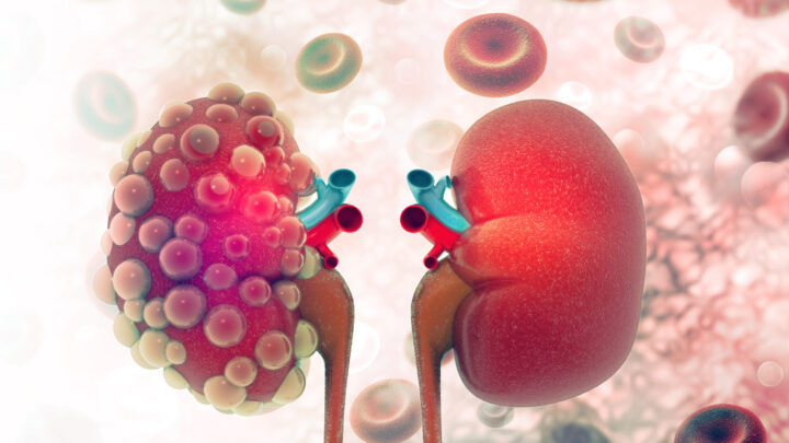 TECNOLOGÍA QUE MEJORA EL CONTROL DE GLUCOSA Y DETECCIÓN TEMPRANA DEL DAÑO RENAL