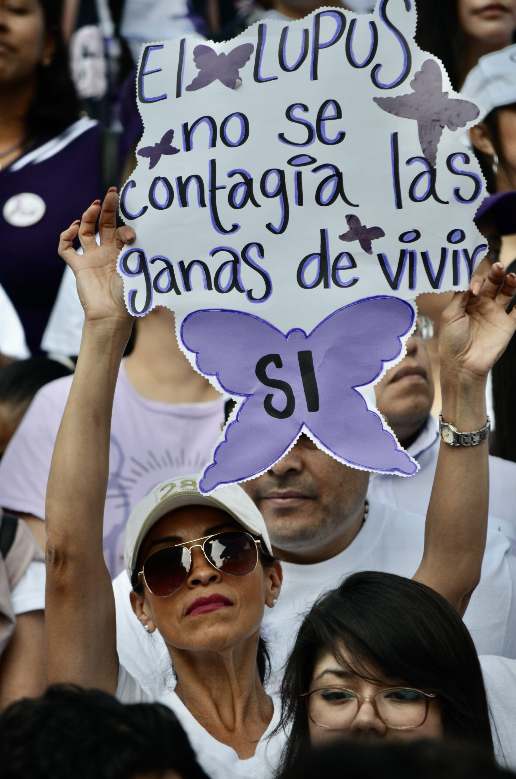 EL 90% DE LAS PERSONAS QUE PADECEN LUPUS, SON MUJERES