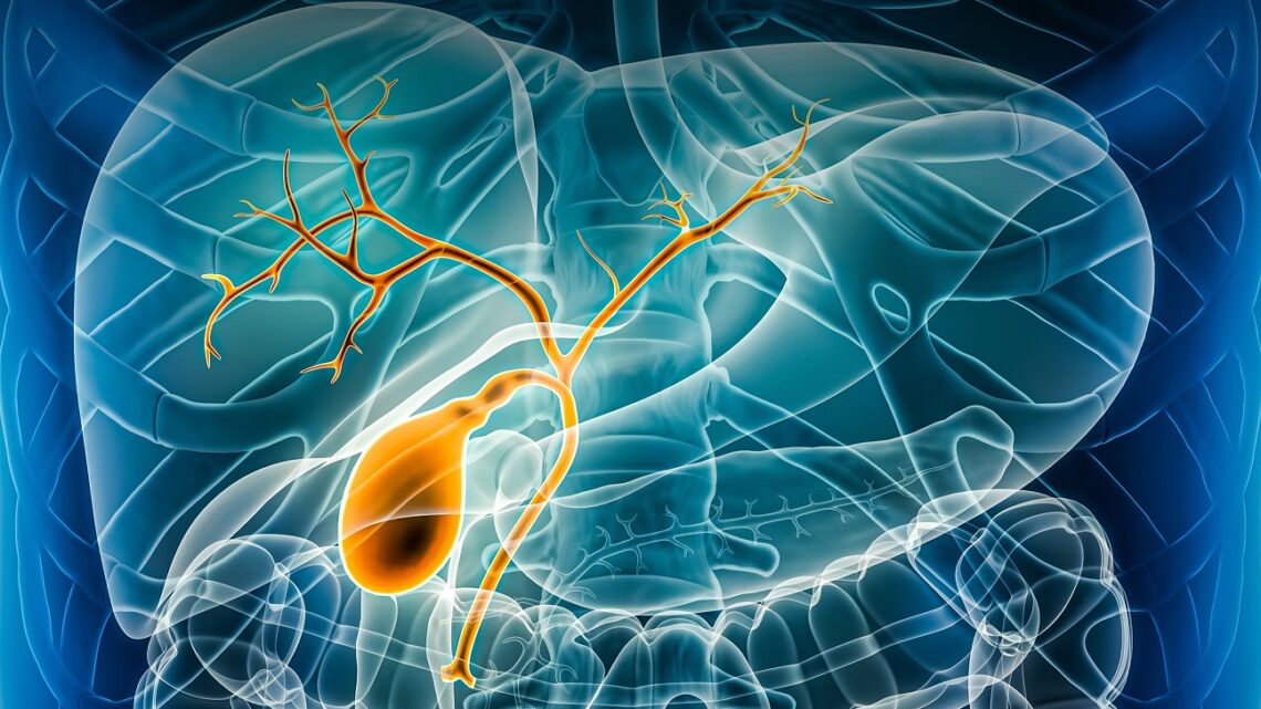 CÁNCER DE VÍAS BILIARES, DIFÍCIL DE DETECTAR