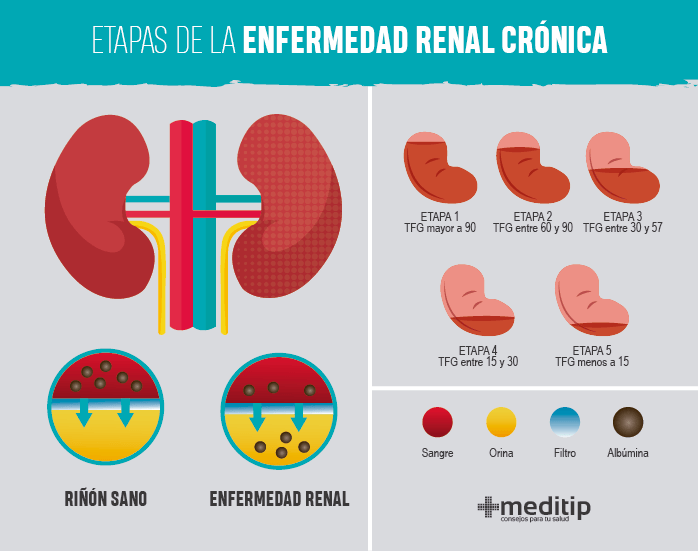 PRIMER PAÍS EN LATINOAMÉRICA CON CONSENSO MÉDICO SOBRE EL USO DE ACA EN ERC