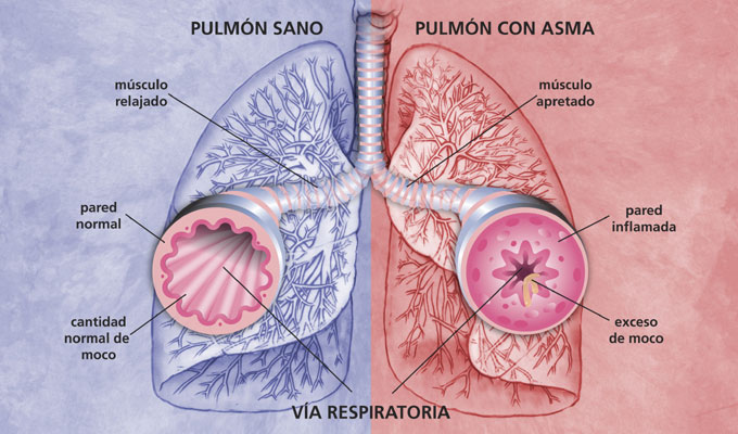 PROYECTO AIRE PROYECTO AIRE