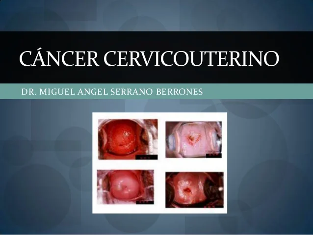 CAMPAÑA NACIONAL DE VACUNACIÓN CONTRA VPH