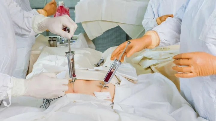 SE REALIZA DE FORMA SIMULTÁNEA TRES TRASPLANTES DE MÉDULA ÓSEA