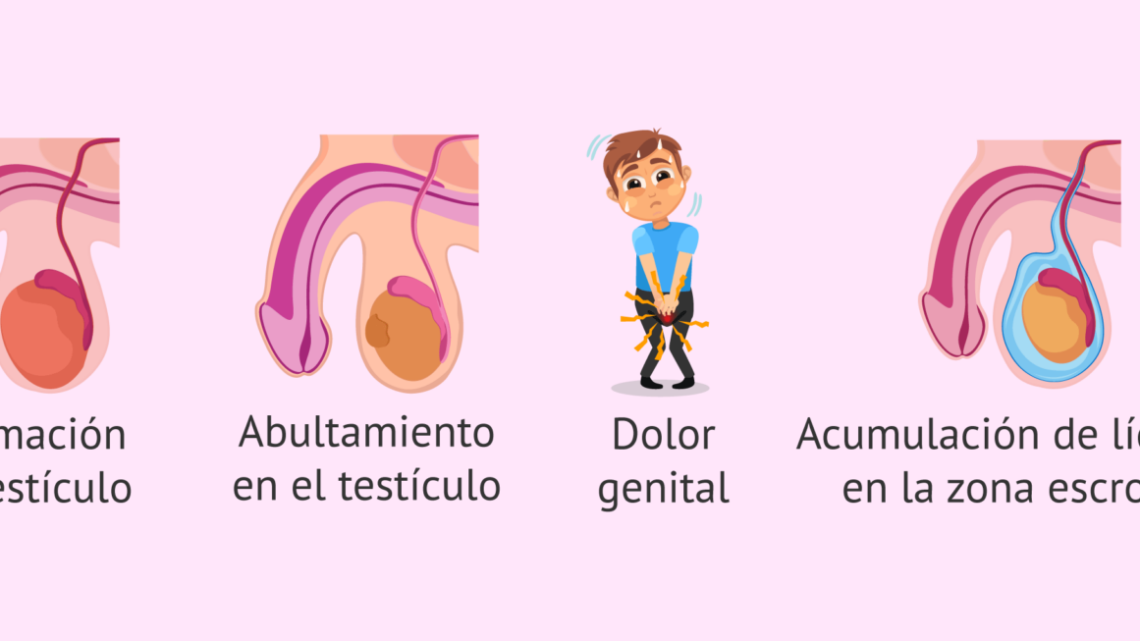 CÁNCER TESTICULAR Y DISFUNCIÓN ERÉCTIL