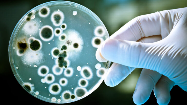 EL BROTE DE INFECCIÓN EN TORRENTE SANGUÍNEO POR KLEBSIELLA OXYTOCA EL BROTE DE INFECCIÓN EN TORRENTE SANGUÍNEO POR KLEBSIELLA OXYTOCA