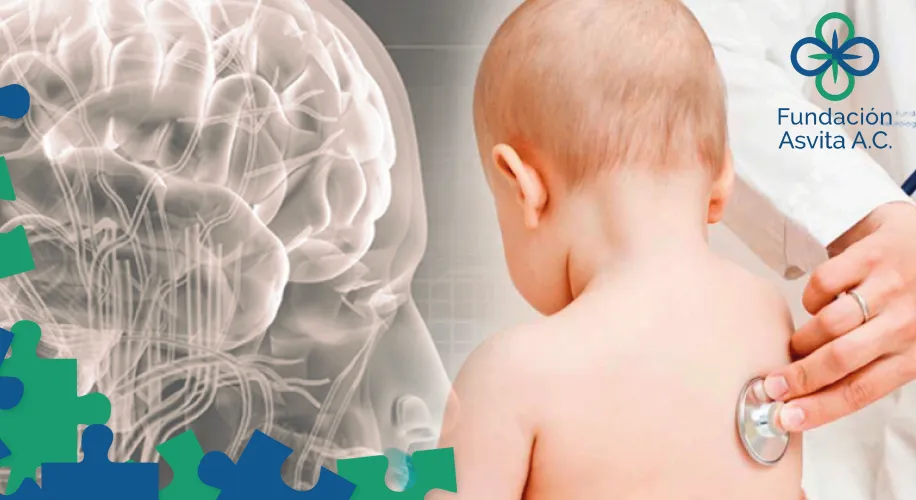 HASTA 40% DE LOS CASOS DE EPILEPSIA INFANTIL SON PREVENIBLES HASTA 40% DE LOS CASOS DE EPILEPSIA INFANTIL SON PREVENIBLES