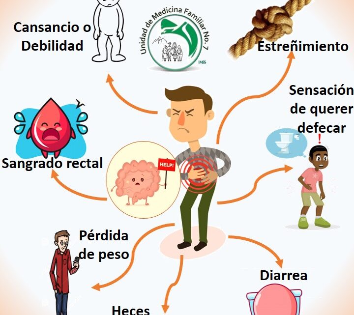 CÁNCER COLORRECTAL