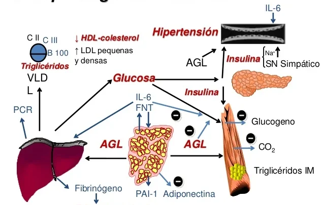 SÍNDROME METABÓLICO, NUEVO FACTOR EN EL AUMENTO DE CIRROSIS HEPÁTICA